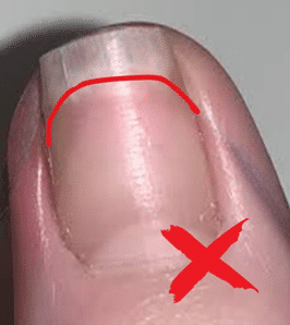 Nail trimming: too rounded